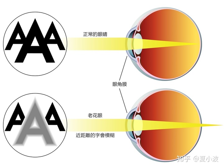 戴错了对眼睛的伤害不可逆！老花镜到底应该怎么选？(图1)