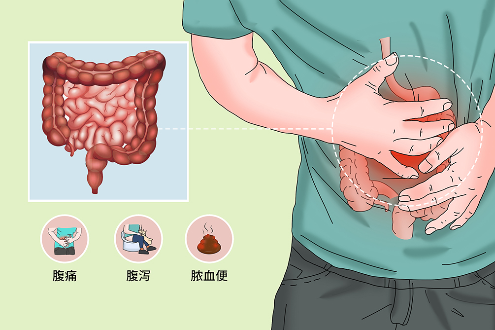 溃疡性结肠炎苦不堪言，中医专家特色方案终治愈(图2)