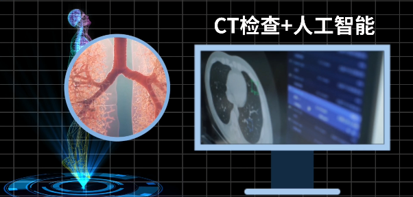 港星肺癌去世，“人工智能”肺癌早筛又火了！(图1)