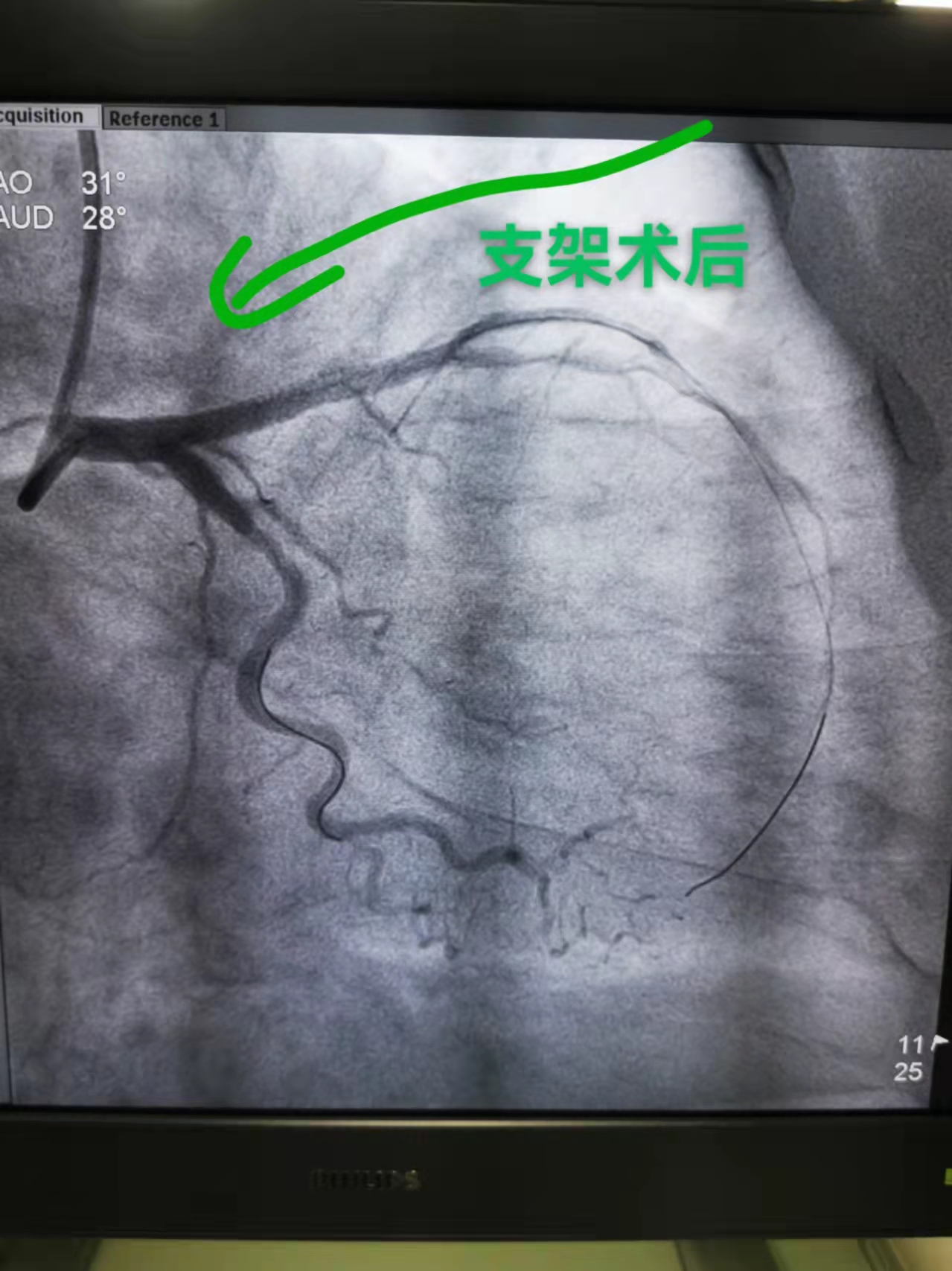 两小时接力救治 两名心梗患者转危为安(图1)