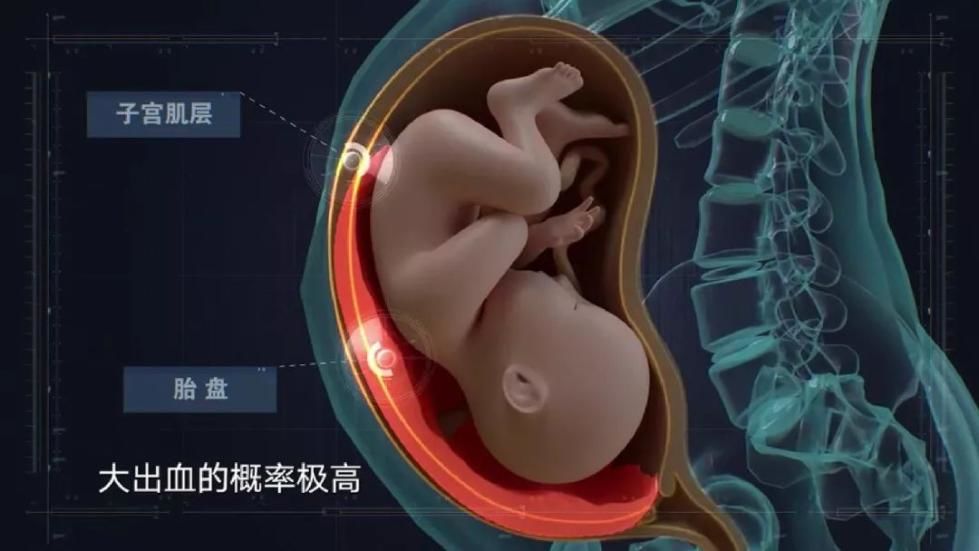 彻夜不眠力保产妇母女平安，患者喜送锦旗感谢救命之恩(图2)