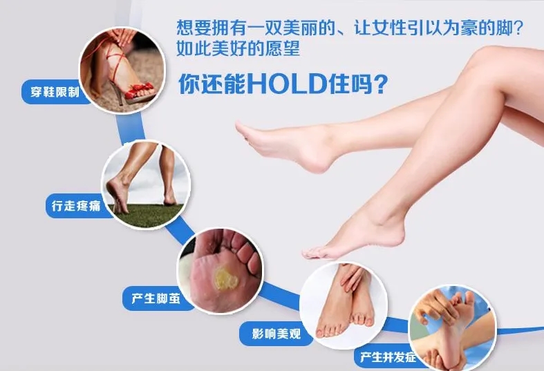 微创矫形术，巧治藏在鞋子里的痛(图1)