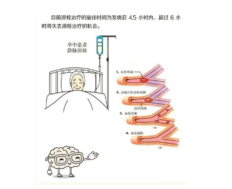 精准救治争分夺秒，脑梗患者重获新生(图1)