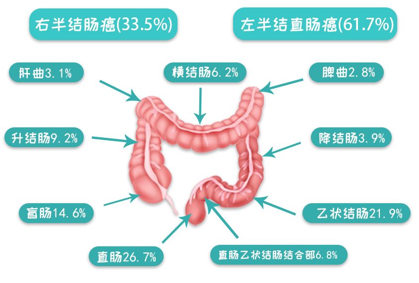 腹痛腹泻做检查，没想到竟查出肠癌！！(图1)
