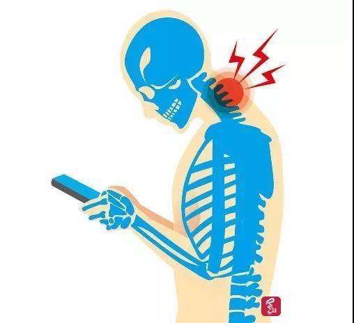 射频消融术，不开刀治疗“难缠”颈椎病(图1)