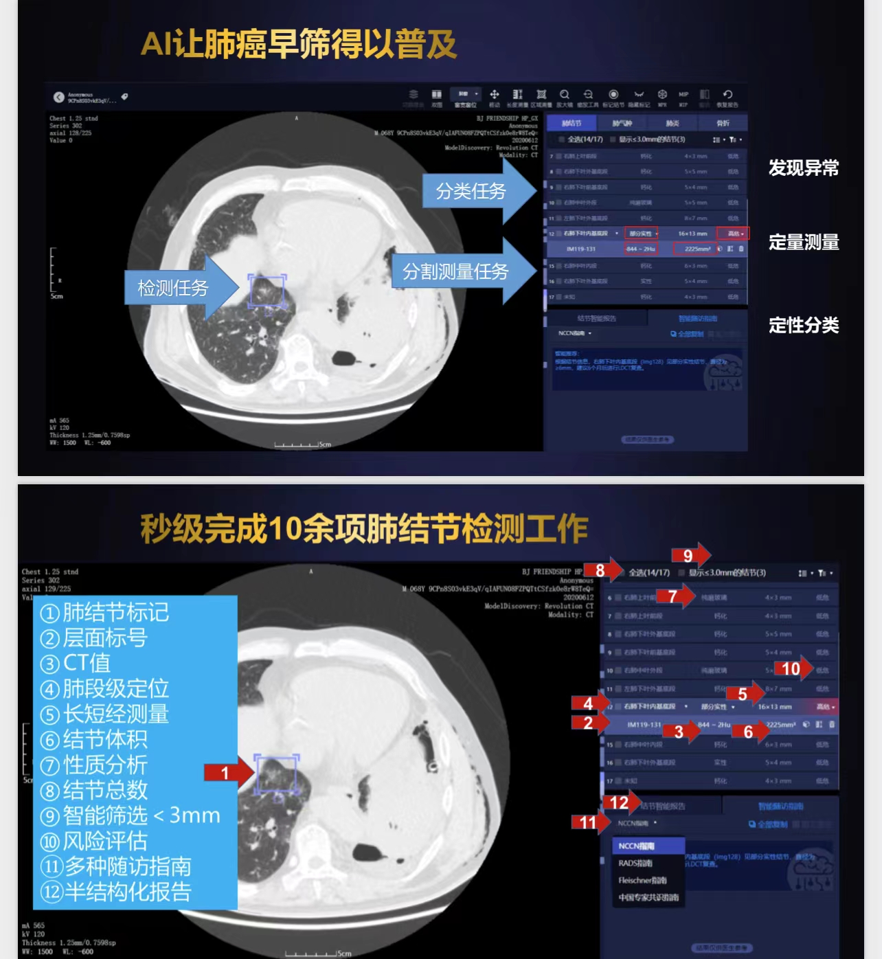 人机合作“组队”阅片，助力精准肺癌筛查！(图3)