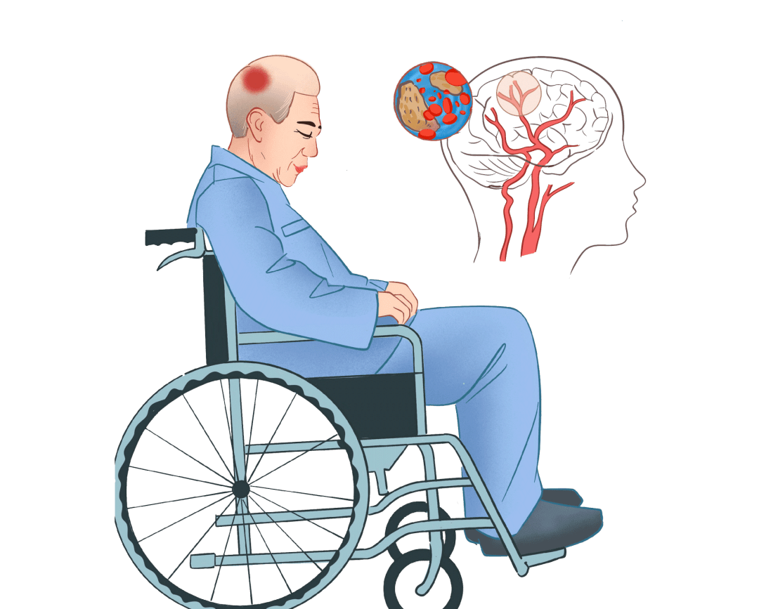 抢抓溶栓黄金时间，助七旬老人逃出“鬼门关”(图1)