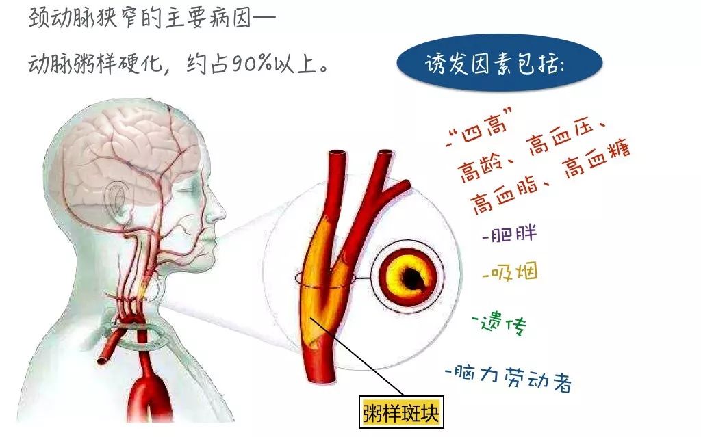 抢抓溶栓黄金时间，助七旬老人逃出“鬼门关”(图2)