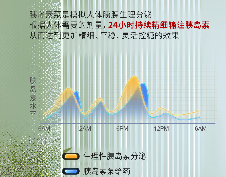 区域内首家|我院常规开展胰岛素泵强化治疗(图1)