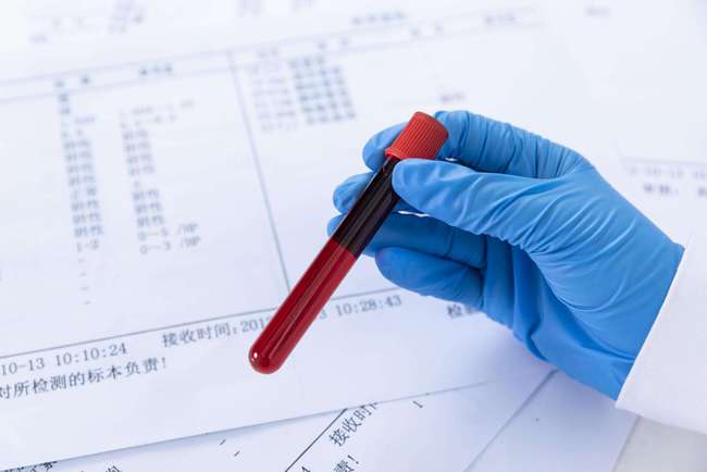 疾病早发现！  康盈医院检验中心新增多项临床检验项目，助力精准诊疗(图1)